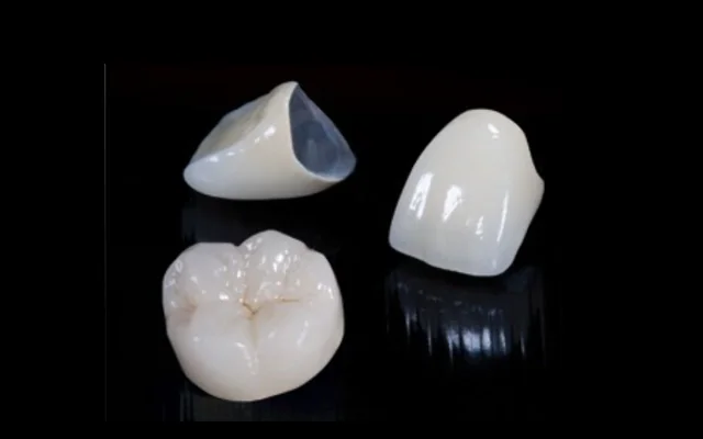 普通金属烤瓷牙